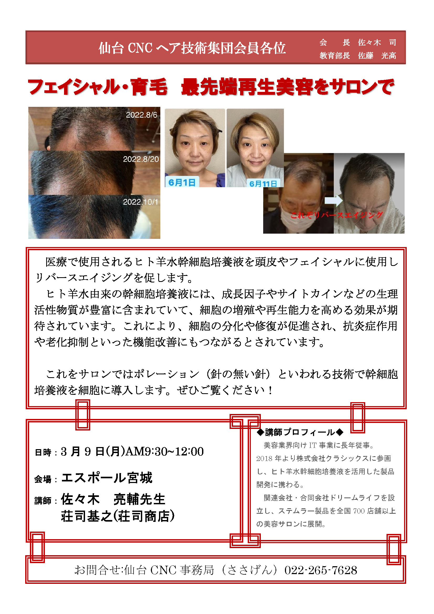 �ե�������롦���ӡ�����ü�������Ƥ򥵥����